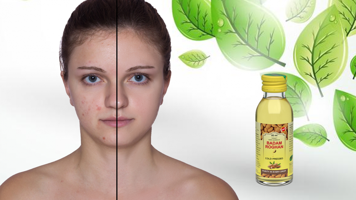 Roghan Badam Almond Oil Benefits
